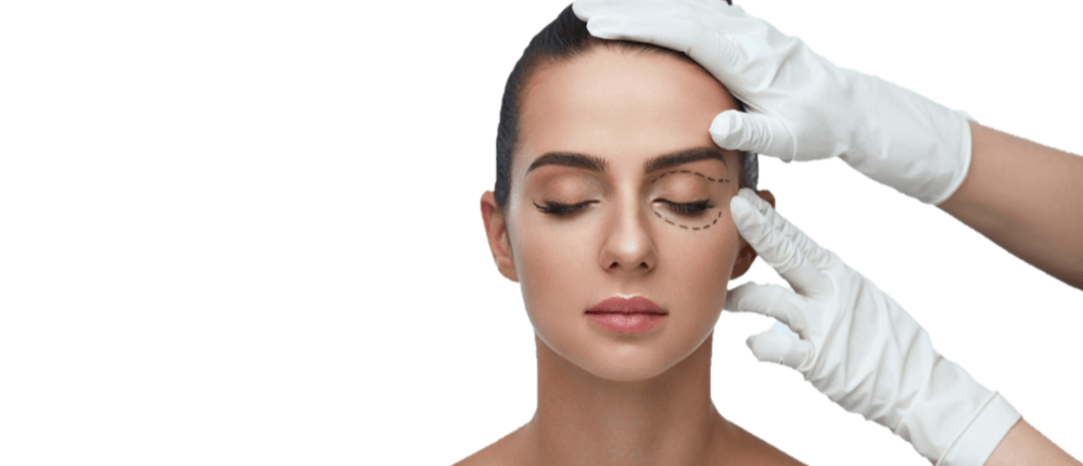 Female-oculoplasty