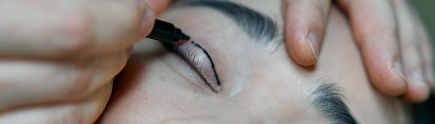 blefaroplastia Que es la blefaroplastia